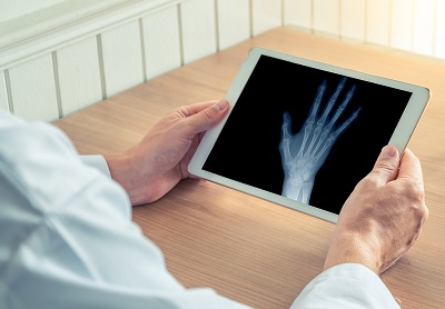Veteran checking X-ray on tablet